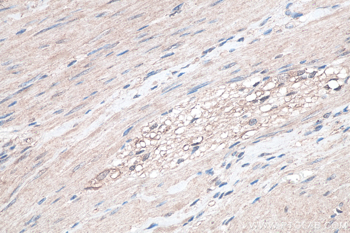 Immunohistochemistry (IHC) staining of human colon tissue using SETDB1 Monoclonal antibody (66293-1-Ig)