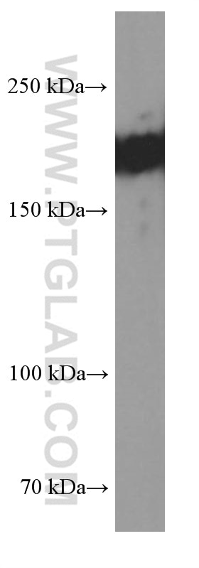 Western Blot (WB) analysis of human heart tissue using SETDB1 Monoclonal antibody (66293-1-Ig)