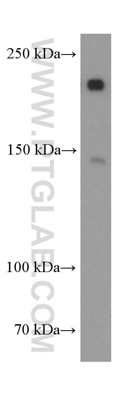 Western Blot (WB) analysis of HEK-293 cells using SETDB1 Monoclonal antibody (66293-1-Ig)