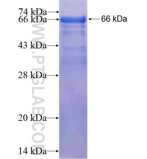 SETDB1 fusion protein Ag1725 SDS-PAGE