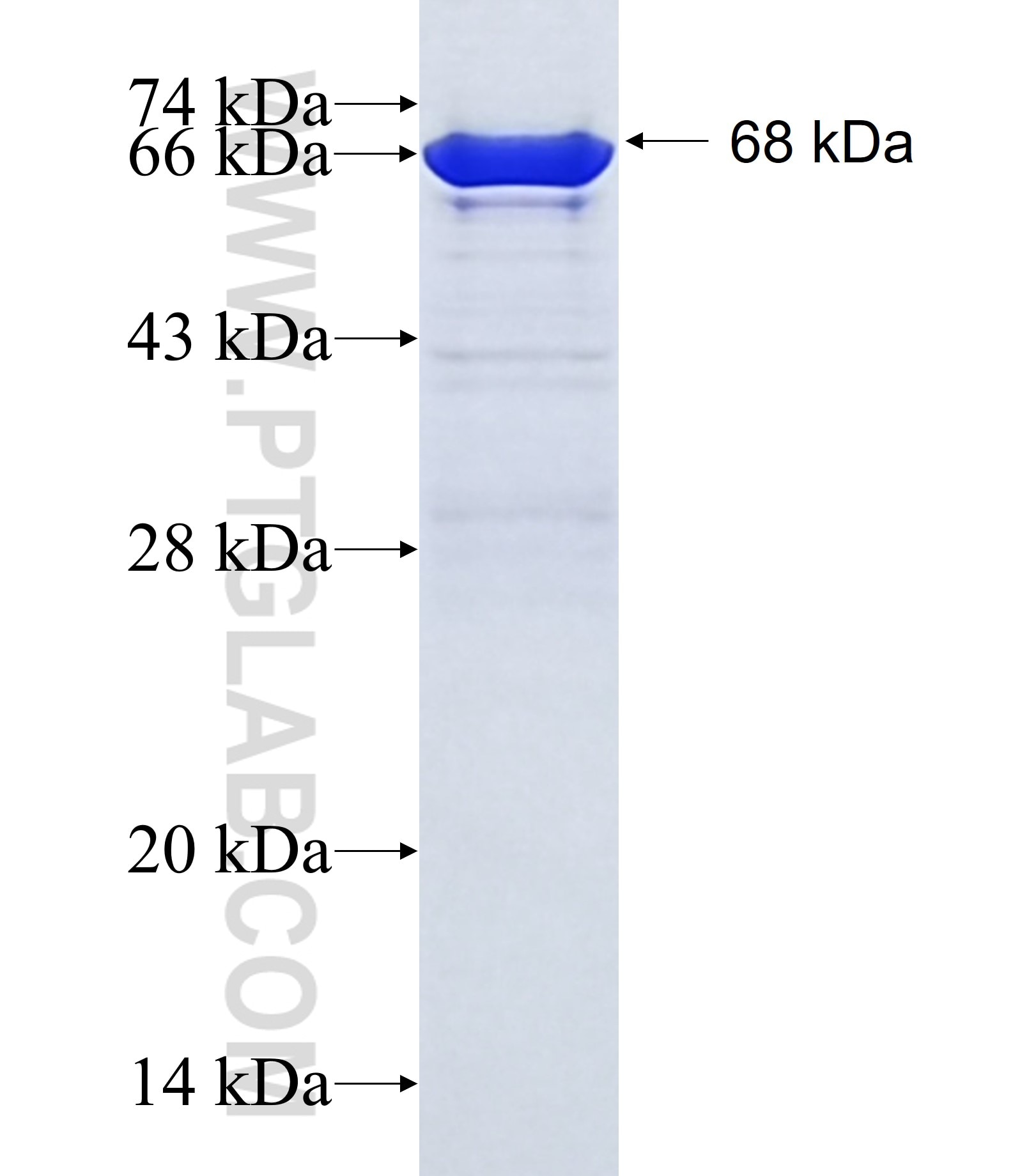 SETDB1 fusion protein Ag1725 SDS-PAGE