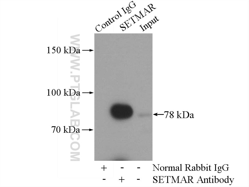 Immunoprecipitation (IP) experiment of HL-60 cells using SETMAR Polyclonal antibody (25814-1-AP)
