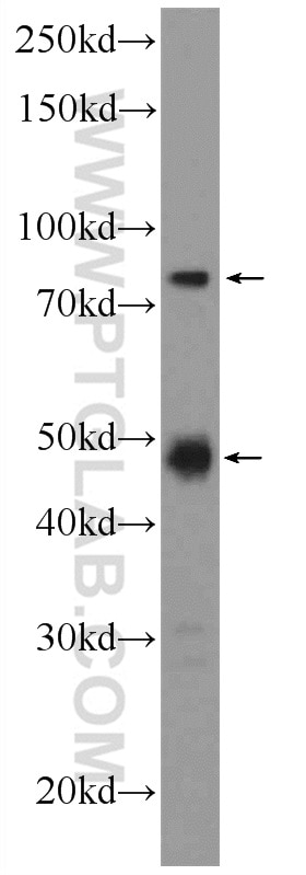 Western Blot (WB) analysis of HL-60 cells using SETMAR Polyclonal antibody (25814-1-AP)
