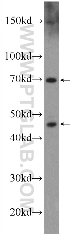 Western Blot (WB) analysis of L02 cells using SETMAR Polyclonal antibody (25814-1-AP)