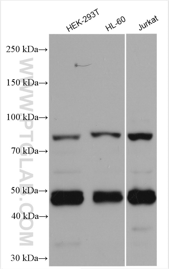 Western Blot (WB) analysis of various lysates using SETMAR Polyclonal antibody (25814-1-AP)