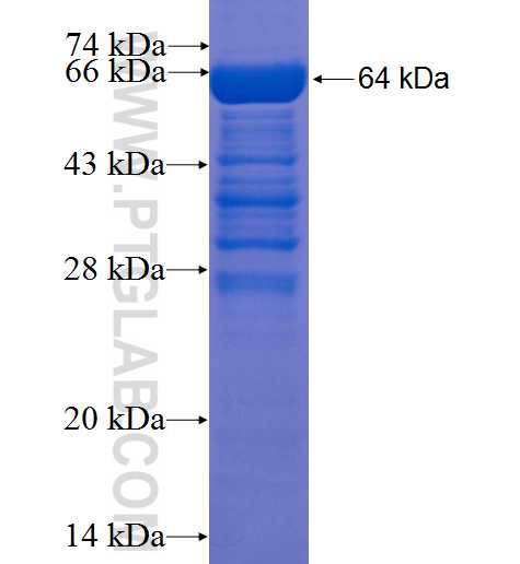 SETMAR fusion protein Ag22938 SDS-PAGE