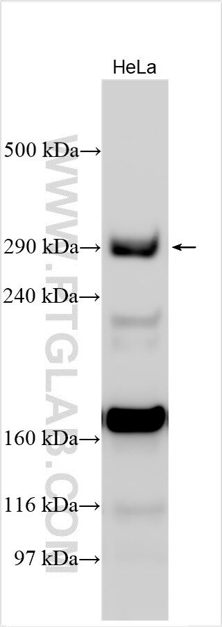 Western Blot (WB) analysis of various lysates using SETX Polyclonal antibody (13837-1-AP)