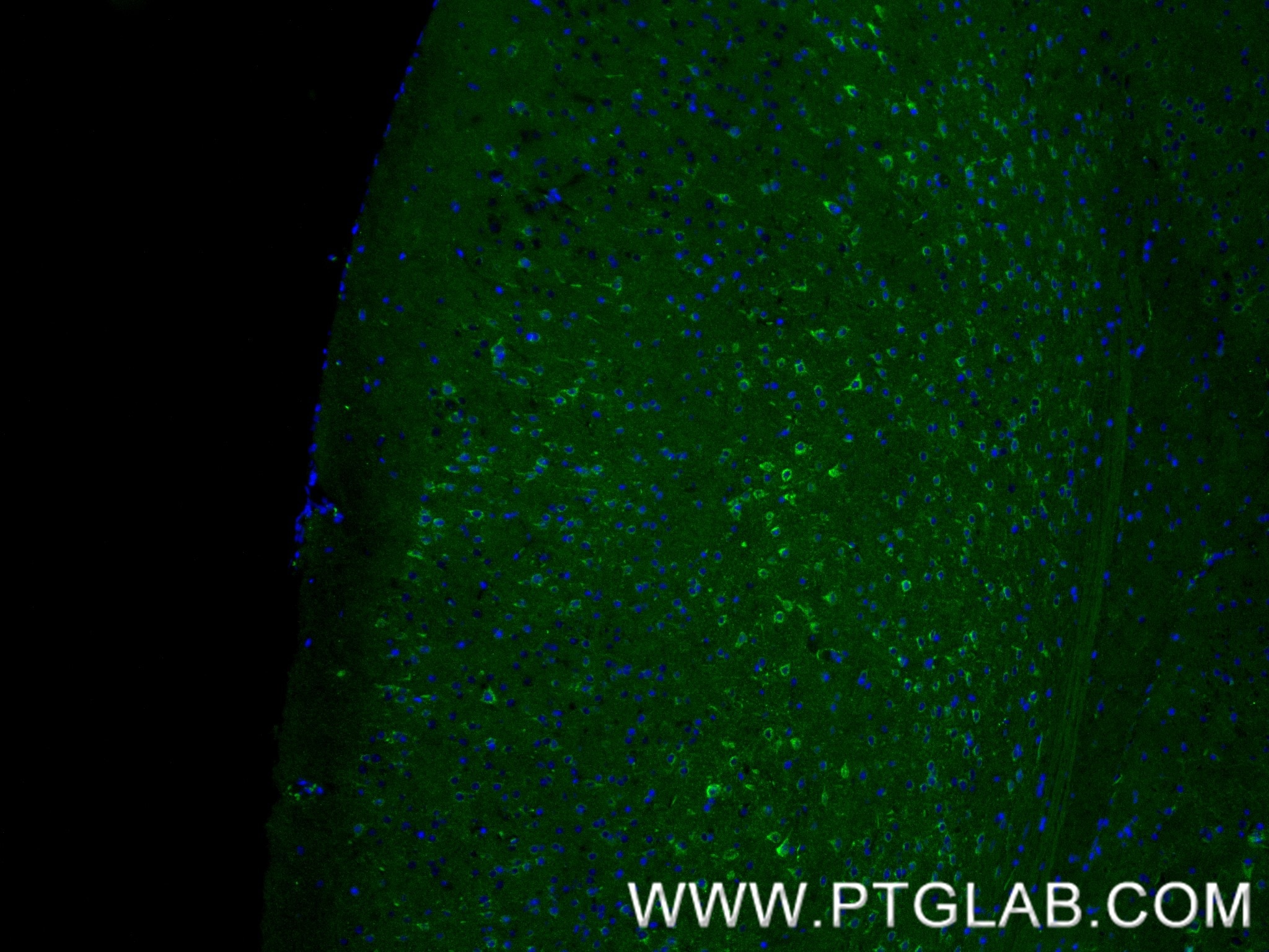IF Staining of mouse brain using 87923-1-RR (same clone as 87923-1-PBS) Immunofluorescence (IF) / fluorescent staining of mouse brain tissue using SEZ6L Recombinant monoclonal antibody (87923-1-RR)