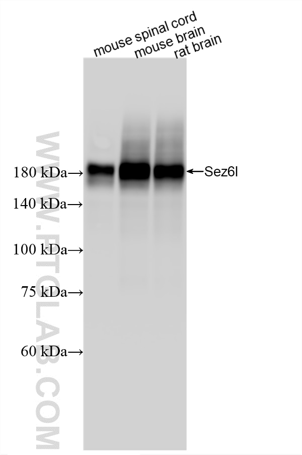WB analysis using 87923-1-RR (same clone as 87923-1-PBS) Western Blot (WB) analysis of various lysates using SEZ6L Recombinant monoclonal antibody (87923-1-RR)