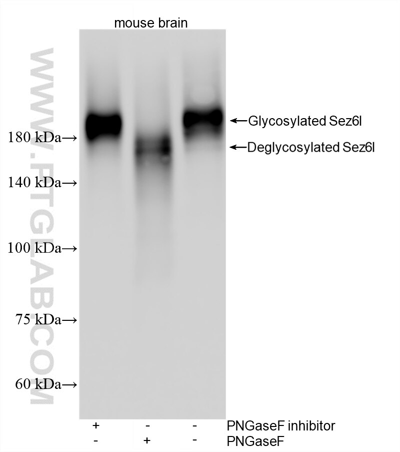 WB analysis using 87923-1-RR (same clone as 87923-1-PBS) Western Blot (WB) analysis of various lysates using SEZ6L Recombinant monoclonal antibody (87923-1-RR)