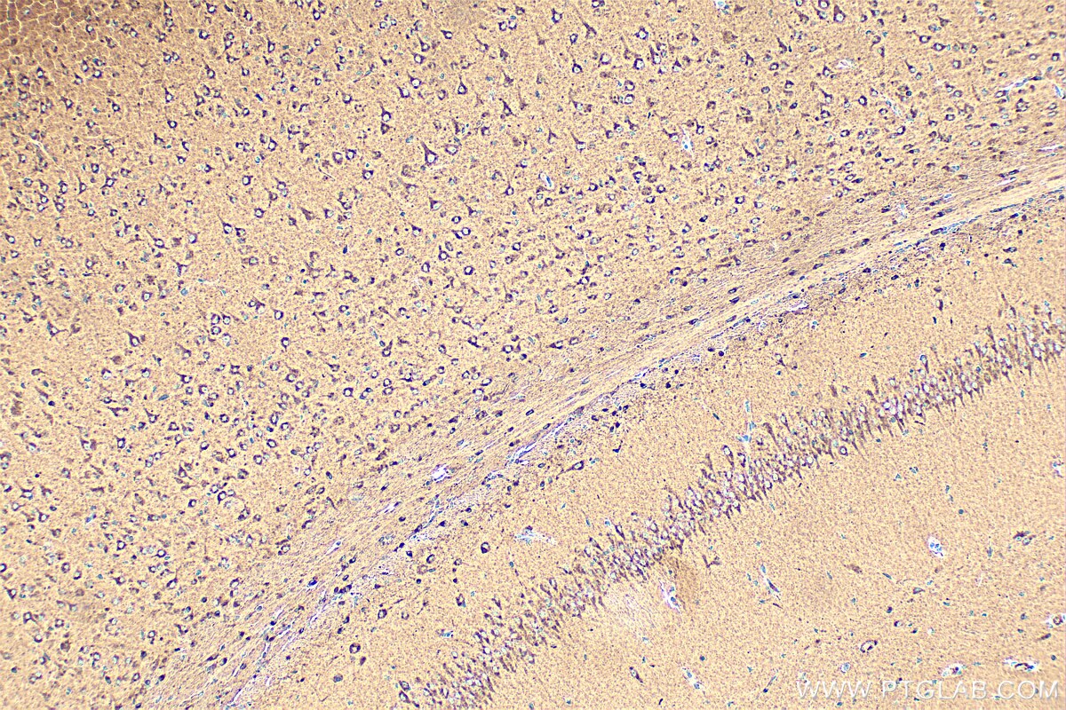 Immunohistochemistry (IHC) staining of mouse brain tissue using SEZ6L2 Polyclonal antibody (19428-1-AP)