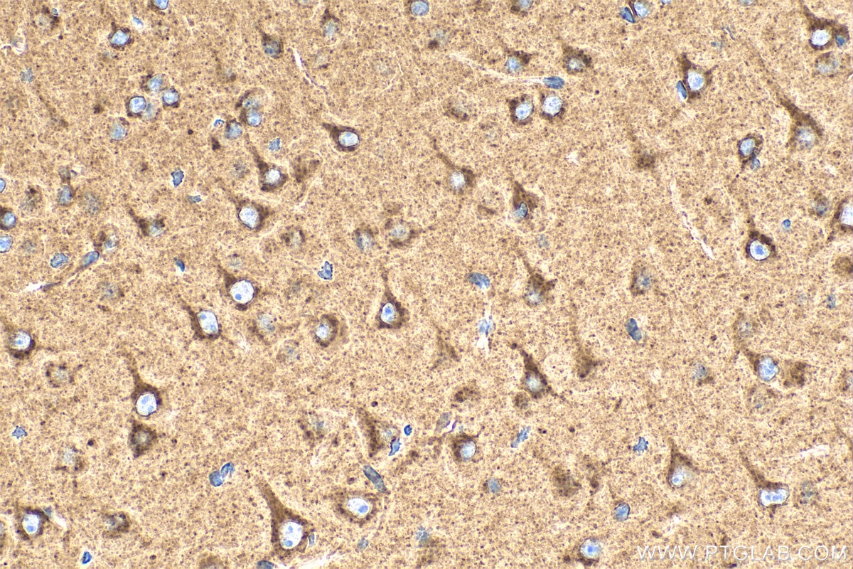 Immunohistochemistry (IHC) staining of mouse brain tissue using SEZ6L2 Polyclonal antibody (19428-1-AP)