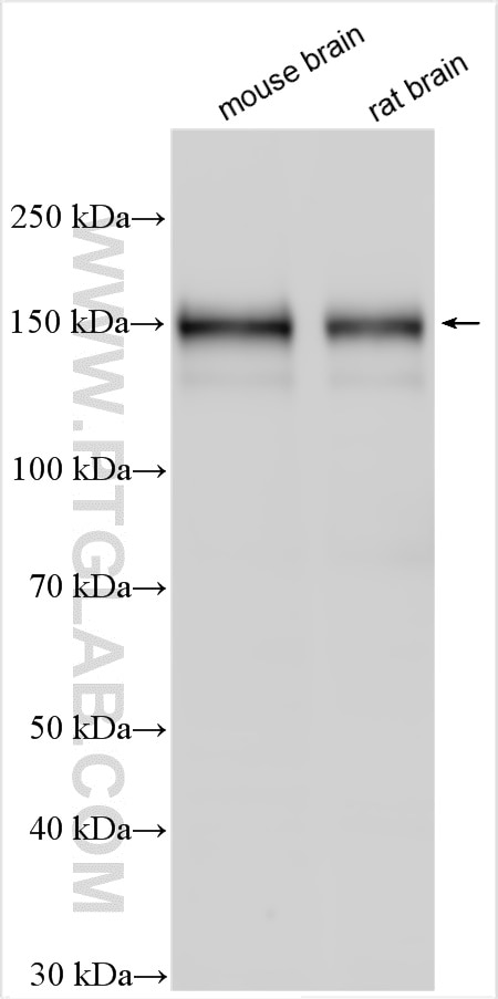 Western Blot (WB) analysis of various lysates using SEZ6L2 Polyclonal antibody (19428-1-AP)