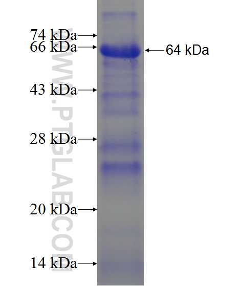 SEZ6L2 fusion protein Ag13760 SDS-PAGE