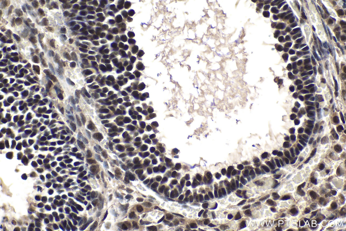Immunohistochemistry (IHC) staining of mouse ovary tissue using SF1 Polyclonal antibody (11635-1-AP)