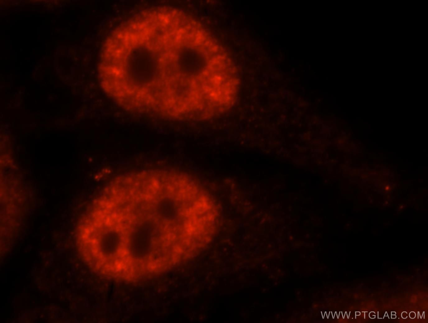 Immunofluorescence (IF) / fluorescent staining of HepG2 cells using SF3A1 Polyclonal antibody (15858-1-AP)