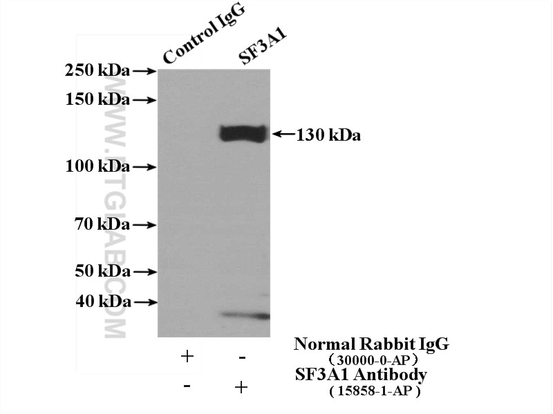 Immunoprecipitation (IP) experiment of mouse brain tissue using SF3A1 Polyclonal antibody (15858-1-AP)