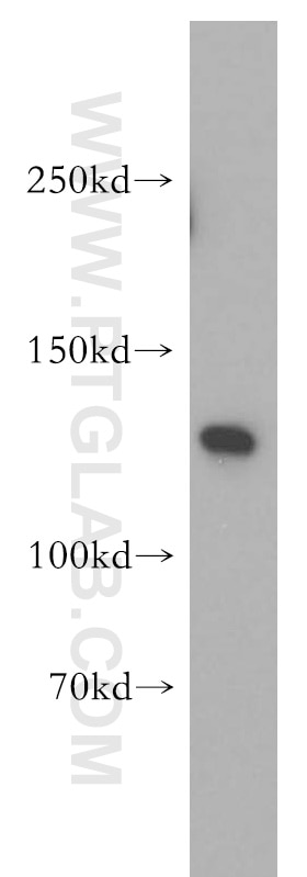 Western Blot (WB) analysis of mouse brain tissue using SF3A1 Polyclonal antibody (15858-1-AP)