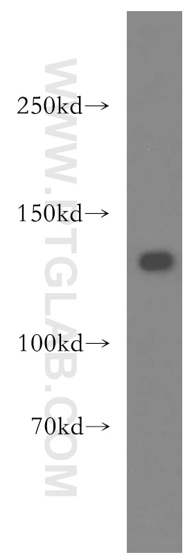 Western Blot (WB) analysis of HL-60 cells using SF3A1 Polyclonal antibody (15858-1-AP)