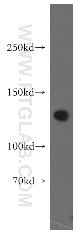 WB analysis of HEK-293 using 15858-1-AP