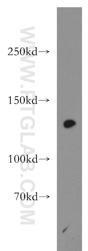 Western Blot (WB) analysis of HeLa cells using SF3A1 Polyclonal antibody (15858-1-AP)