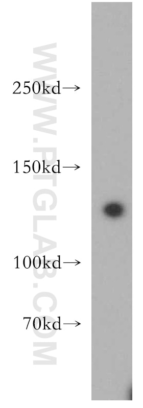 Western Blot (WB) analysis of mouse lung tissue using SF3A1 Polyclonal antibody (15858-1-AP)