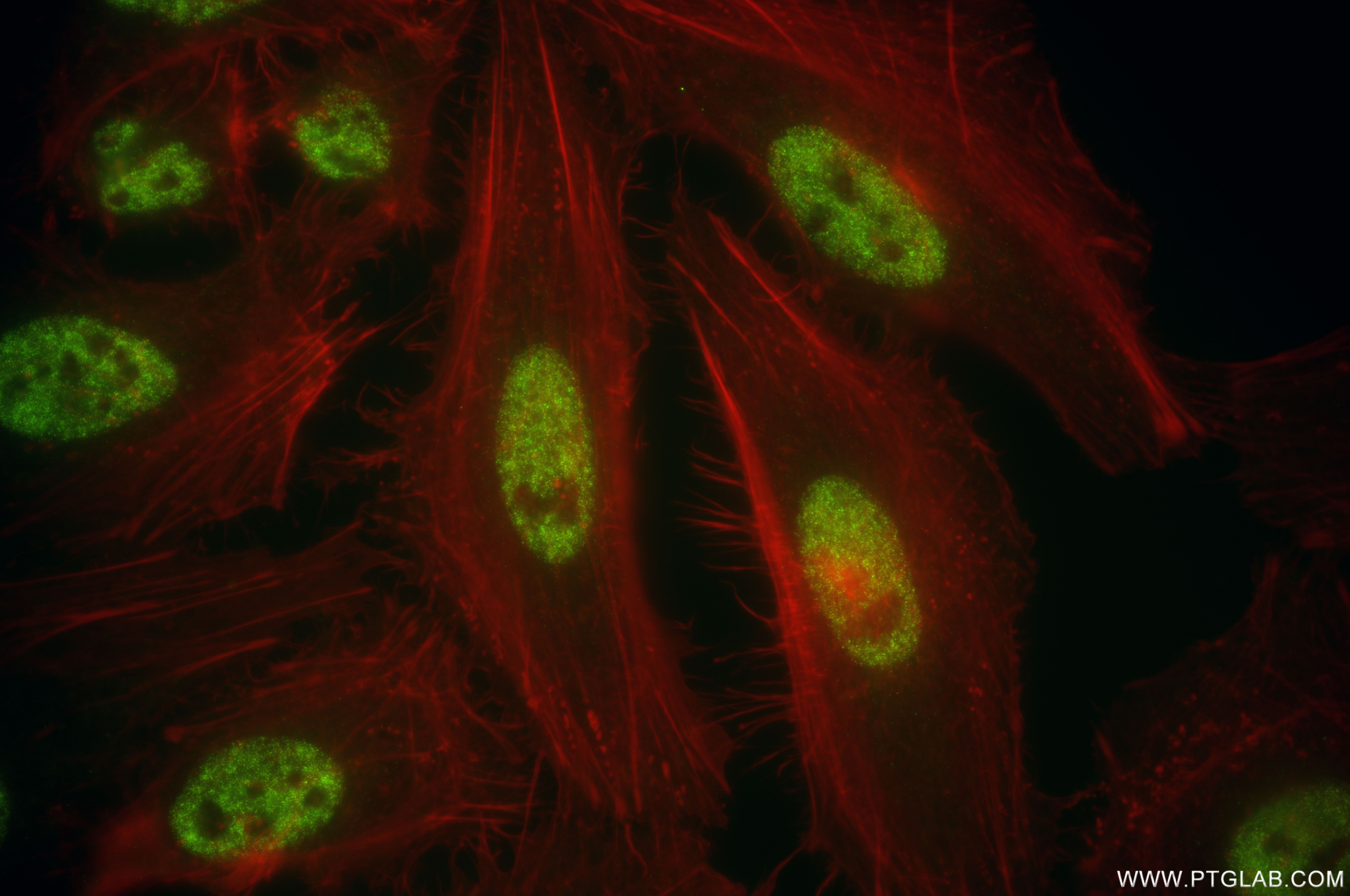 Immunofluorescence (IF) / fluorescent staining of HeLa cells using SF3A1 Recombinant antibody (86170-2-RR)
