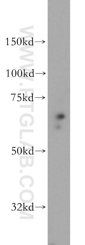 Western Blot (WB) analysis of HeLa cells using SF3A2 Polyclonal antibody (15596-1-AP)