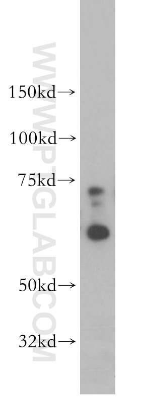 Western Blot (WB) analysis of HeLa cells using SF3A2 Polyclonal antibody (15596-1-AP)
