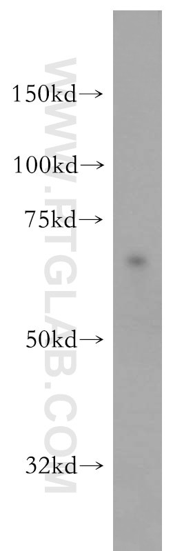 Western Blot (WB) analysis of NIH/3T3 cells using SF3A2 Polyclonal antibody (15596-1-AP)