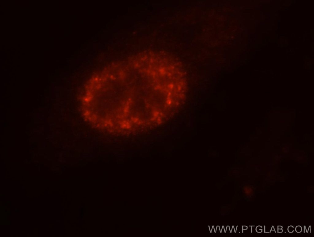 Immunofluorescence (IF) / fluorescent staining of HeLa cells using SF3A3 Polyclonal antibody (12070-1-AP)