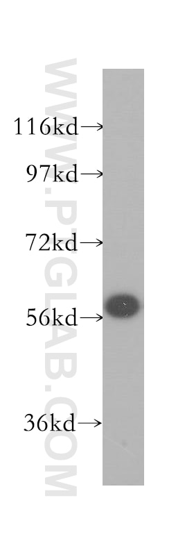 Western Blot (WB) analysis of Raji cells using SF3A3 Polyclonal antibody (12070-1-AP)