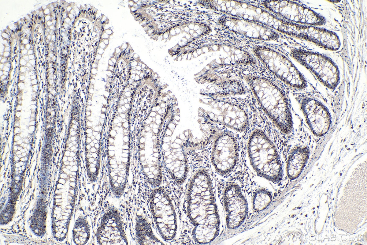 Immunohistochemistry (IHC) staining of human colon tissue using SF3B1 Polyclonal antibody (27684-1-AP)