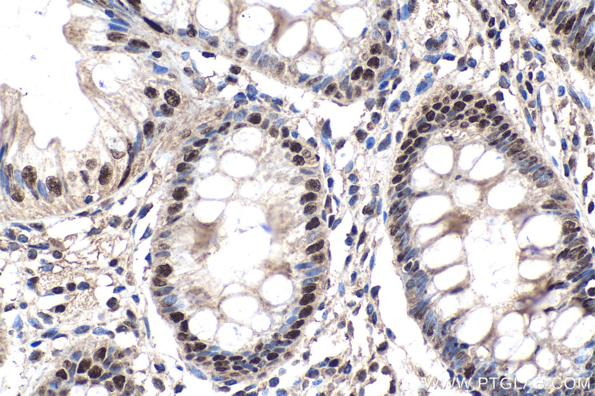 Immunohistochemistry (IHC) staining of human colon tissue using SF3B1 Polyclonal antibody (27684-1-AP)