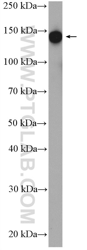 Western Blot (WB) analysis of U2OS cells using SF3B1 Polyclonal antibody (27684-1-AP)
