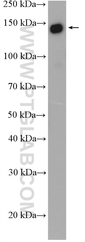 Western Blot (WB) analysis of MCF-7 cells using SF3B1 Polyclonal antibody (27684-1-AP)