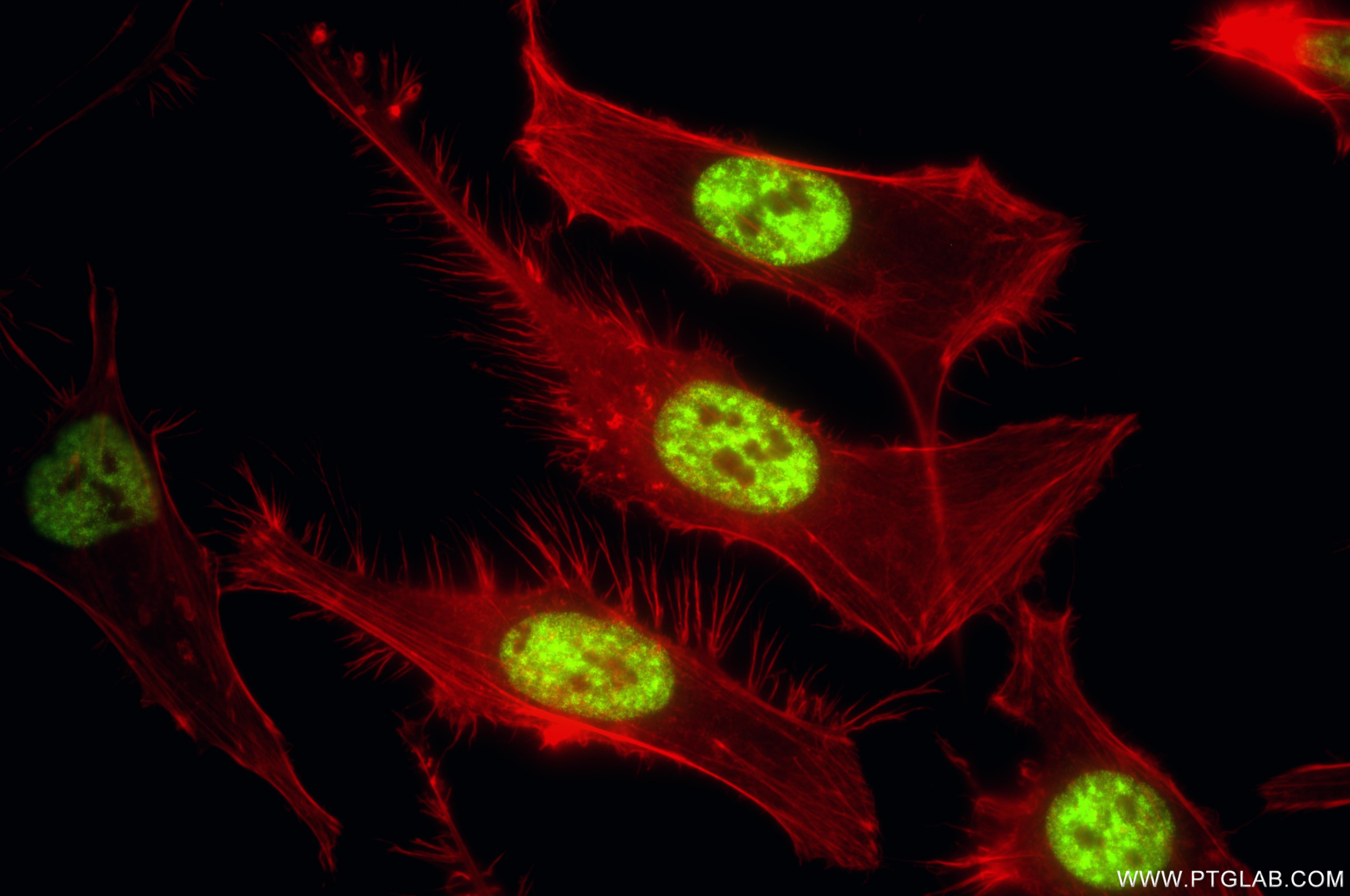 Immunofluorescence (IF) / fluorescent staining of HeLa cells using SF3B1 Recombinant monoclonal antibody (85640-4-RR)