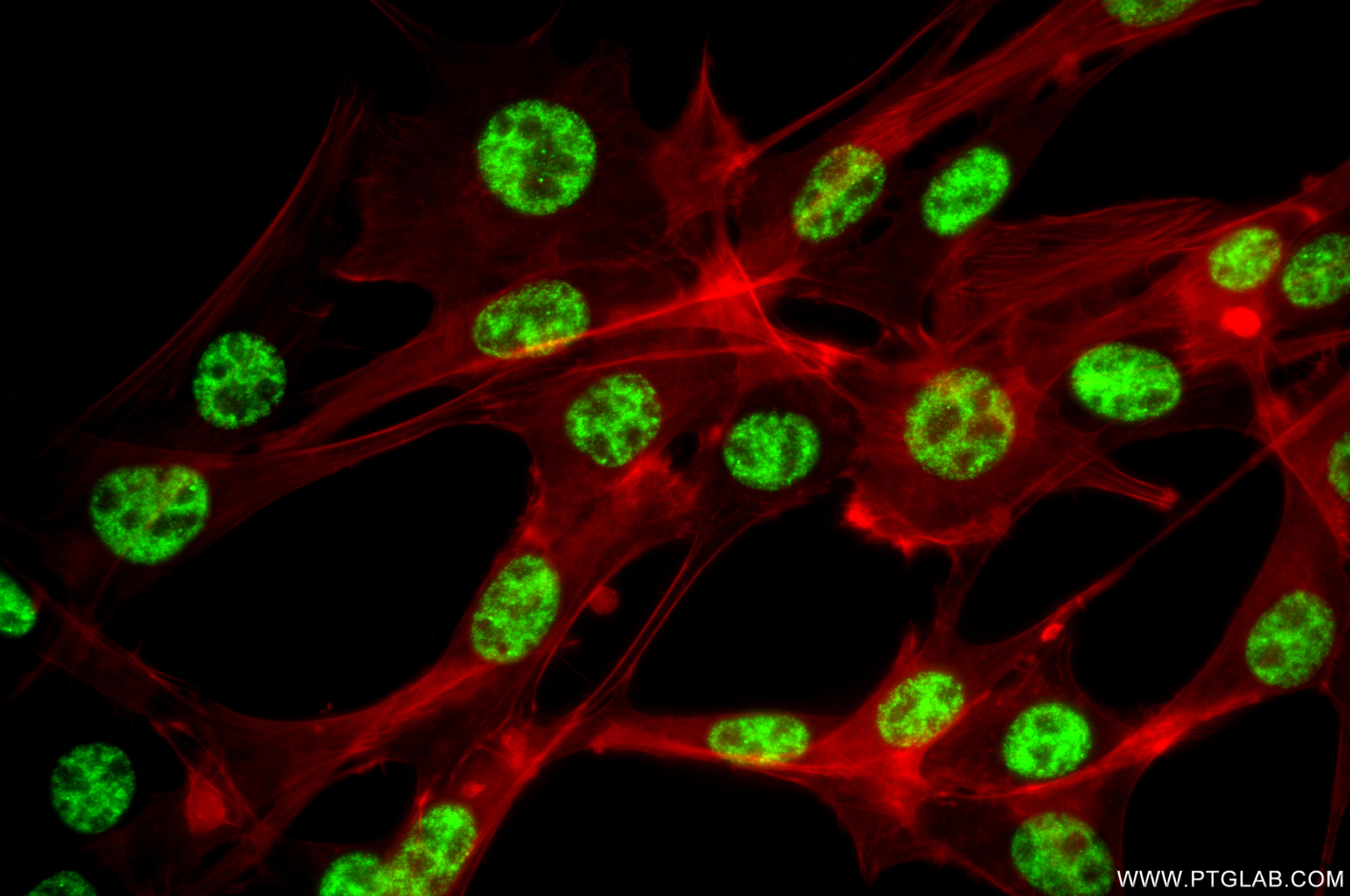 Immunofluorescence (IF) / fluorescent staining of NIH/3T3 cells using SF3B1 Recombinant monoclonal antibody (85640-4-RR)