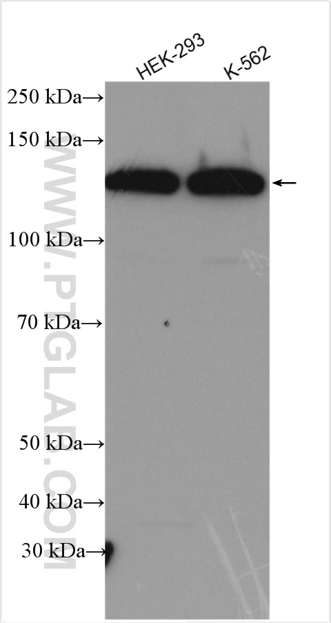 Western Blot (WB) analysis of various lysates using SF3B2 Polyclonal antibody (10919-1-AP)