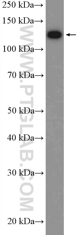 Western Blot (WB) analysis of K-562 cells using SF3B2 Polyclonal antibody (10919-1-AP)