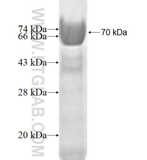 SF3B2 fusion protein Ag1009 SDS-PAGE