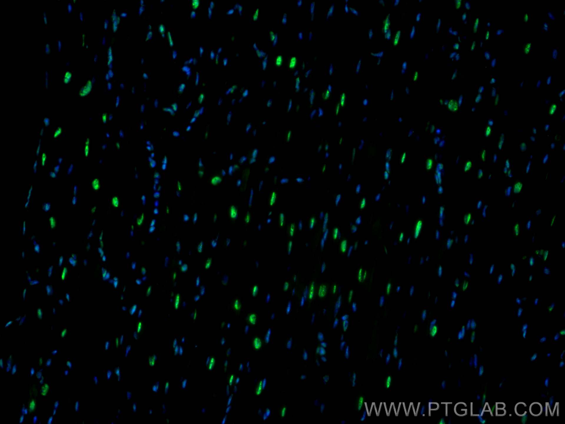 Immunofluorescence (IF) / fluorescent staining of mouse heart tissue using SF3B3 Polyclonal antibody (14577-1-AP)