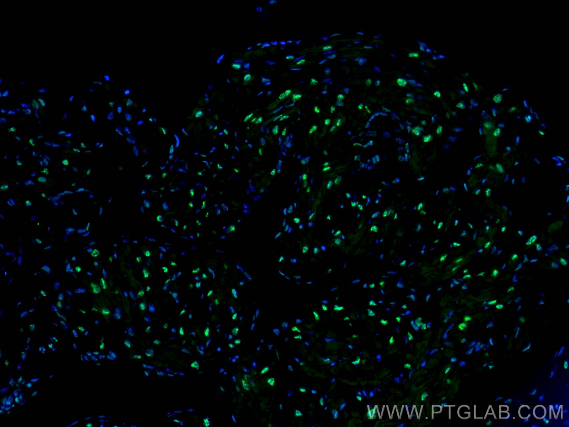 Immunofluorescence (IF) / fluorescent staining of mouse heart tissue using SF3B3 Polyclonal antibody (14577-1-AP)