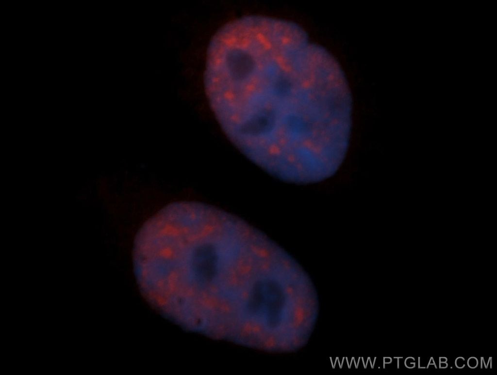 Immunofluorescence (IF) / fluorescent staining of HeLa cells using SF3B3 Polyclonal antibody (14577-1-AP)