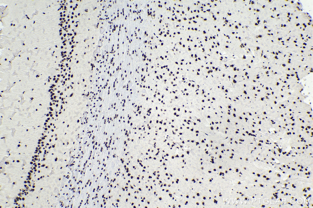 Immunohistochemistry (IHC) staining of rat brain tissue using SF3B3 Polyclonal antibody (14577-1-AP)