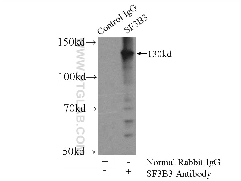 Immunoprecipitation (IP) experiment of rat brain tissue using SF3B3 Polyclonal antibody (14577-1-AP)