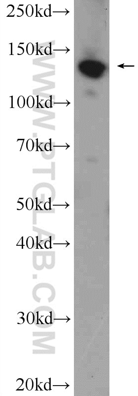 Western Blot (WB) analysis of rat brain tissue using SF3B3 Polyclonal antibody (14577-1-AP)