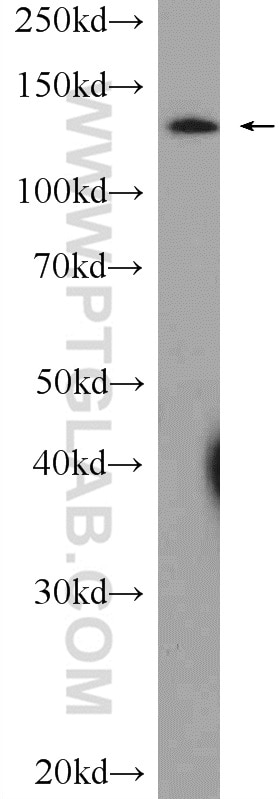 Western Blot (WB) analysis of rat heart tissue using SF3B3 Polyclonal antibody (14577-1-AP)