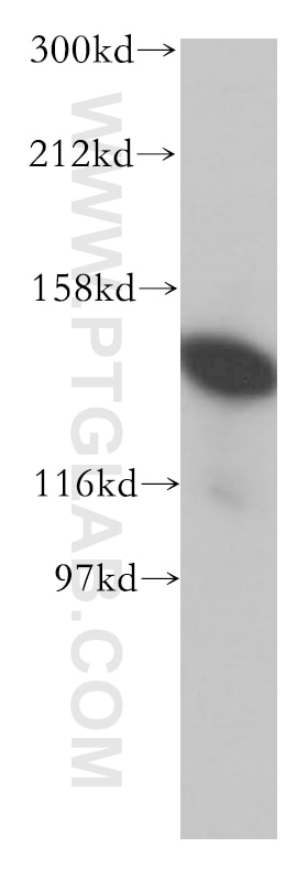 Western Blot (WB) analysis of human brain tissue using SF3B3 Polyclonal antibody (14577-1-AP)