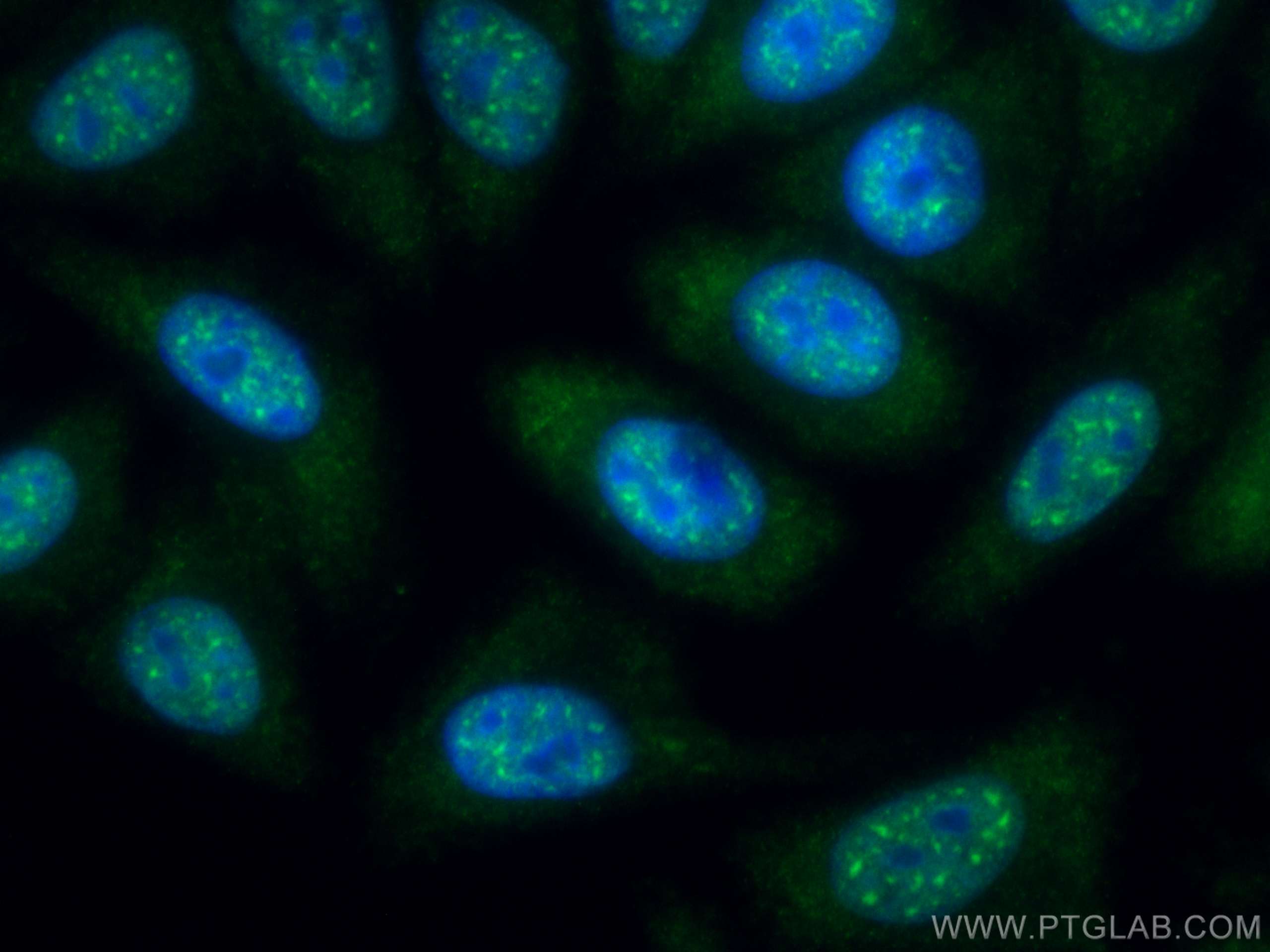 IF Staining of HepG2 using CL488-67469